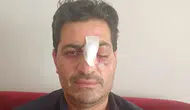 Cami Avlusunda Din Görevlisine Saldırı Tepki Çekti: Burnu Kırılan Müezzin İçin Suç Duyurusu Takibi