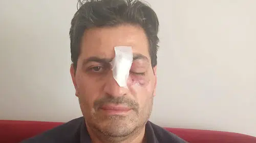 Cami Avlusunda Din Görevlisine Saldırı Tepki Çekti: Burnu Kırılan Müezzin İçin Suç Duyurusu Takibi